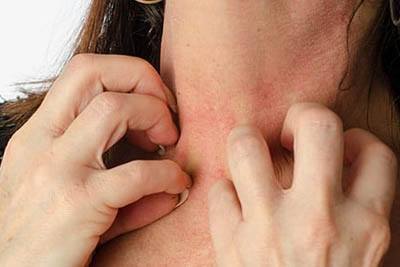 Allergy causes