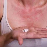 Drug Allergies