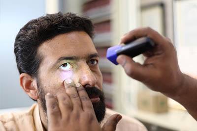 Conjunctivitis causes