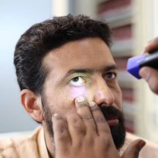 Glaucoma symptoms
