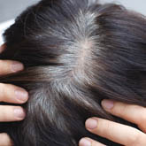 Premature Greying of Hair Treatment