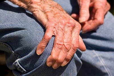 Osteoarthritis causes