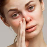 Allergic Rhinitis