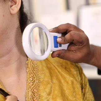 Eczema symptoms