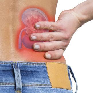Kidney Stones symptoms