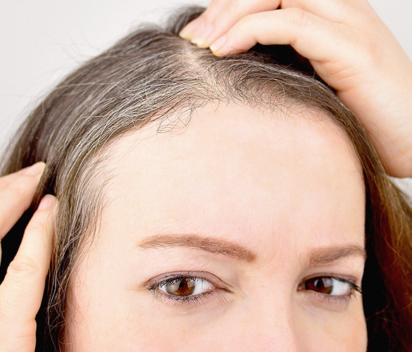 Best homeopathic doctor meerut for hair problems | Homeothics
